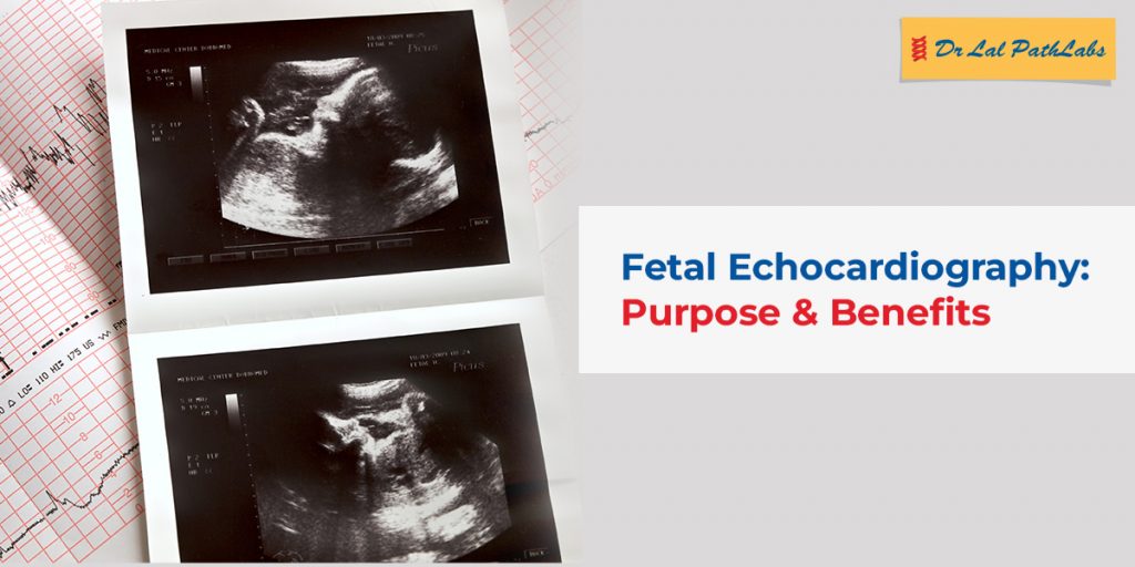 Fetal Echocardiography: Purpose, Procedure & Benefits Explained