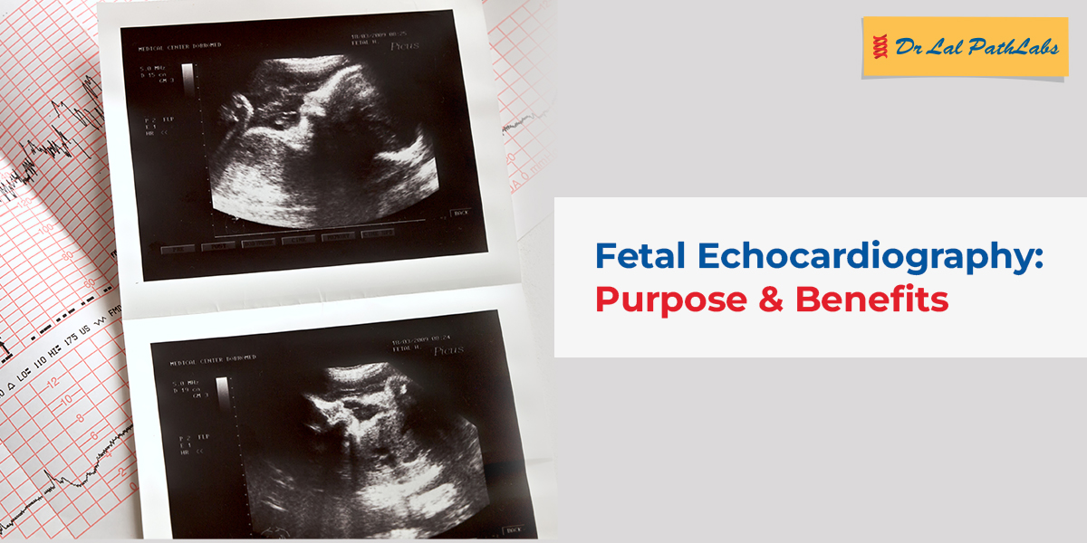 Fetal Echocardiography