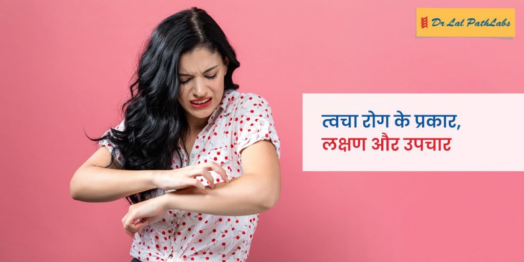 त्वचा रोग: प्रकार, लक्षण, उपचार और रोकथाम