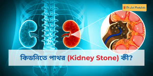 Kidney Stone in Bengali