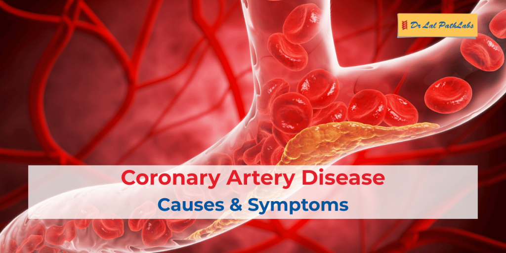 Coronary Artery Disease: Causes, Symptoms & Diagnosis