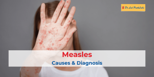 measles
