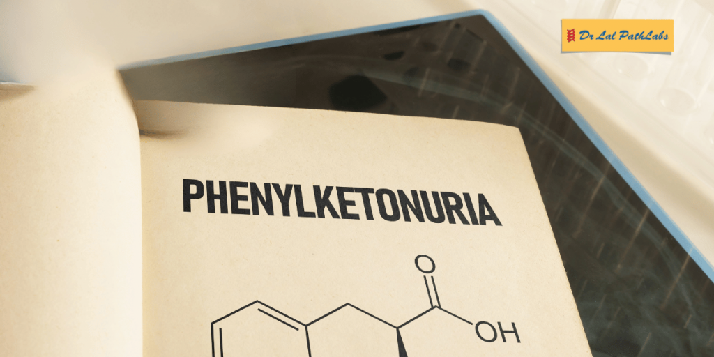 Phenylketonuria (PKU): Causes, Symptoms, Diagnosis & Treatment