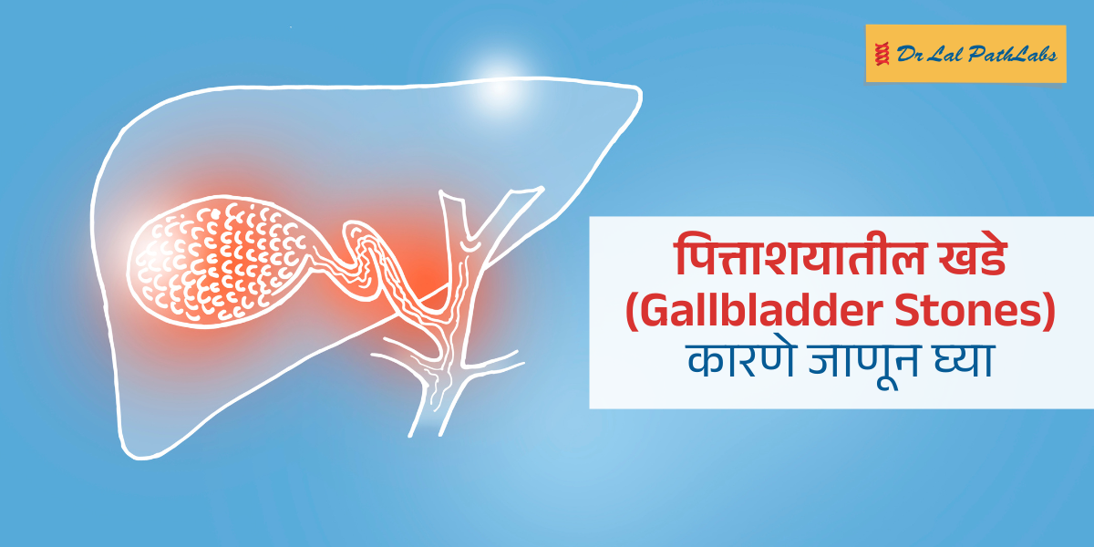 पित्ताशयाचे
