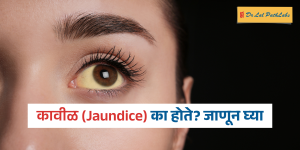 jaundice in marathi