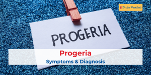 progeria symptoms