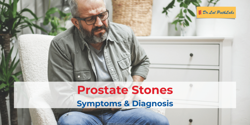 Prostate Stones Explained Symptoms, Risk Factors & Diagnosis