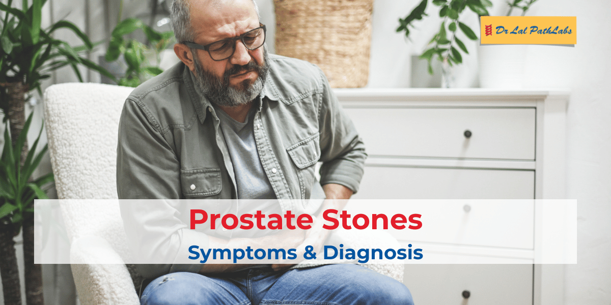 prostate stones
