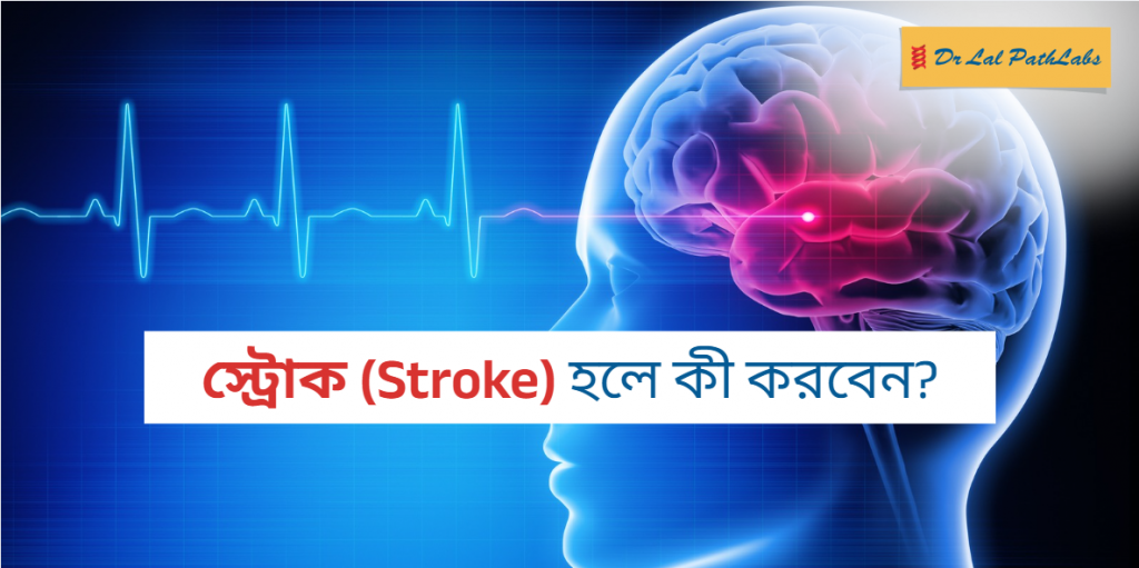 কেন স্ট্রোক হয়? জেনে নিন স্ট্রোকের লক্ষণ, কারণ ও প্রাথমিক চিকিৎসা