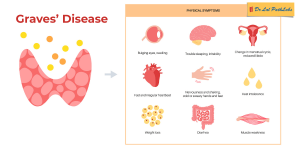 graves disease