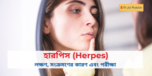herpes bengali