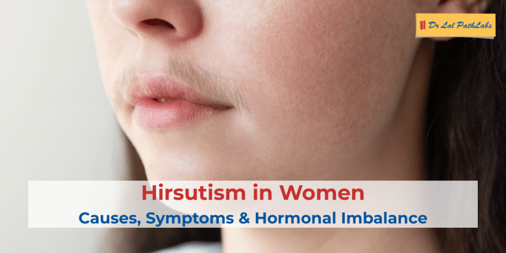hirsutism