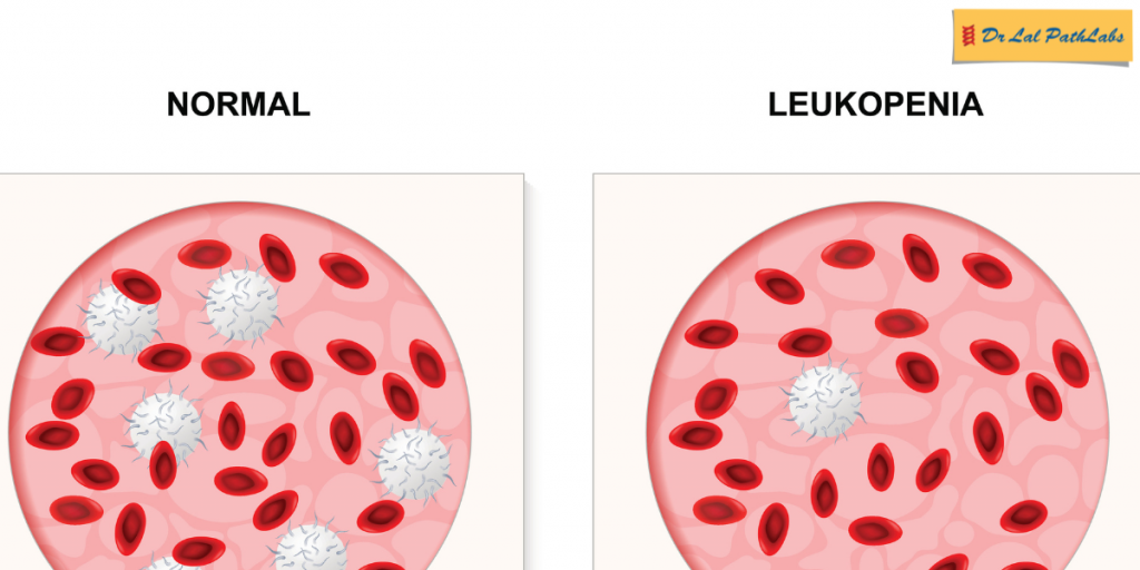 Leukopenia