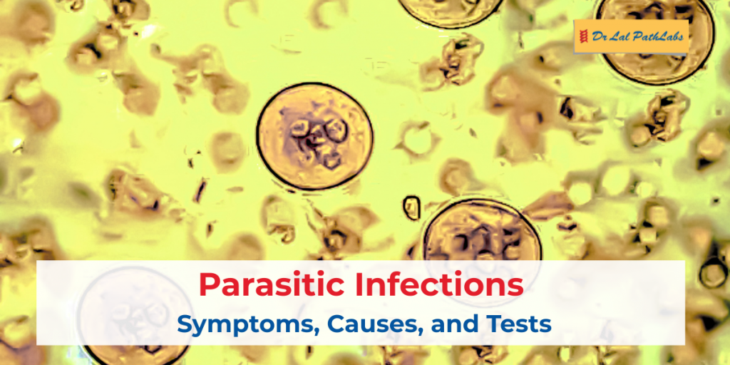 Parasitic Infections