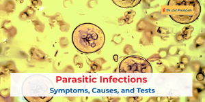 Parasitic Infections