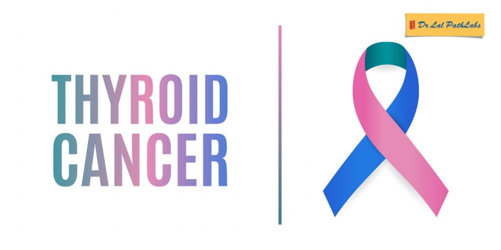 thyroid cancer