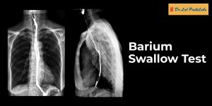 Barium Swallow Test