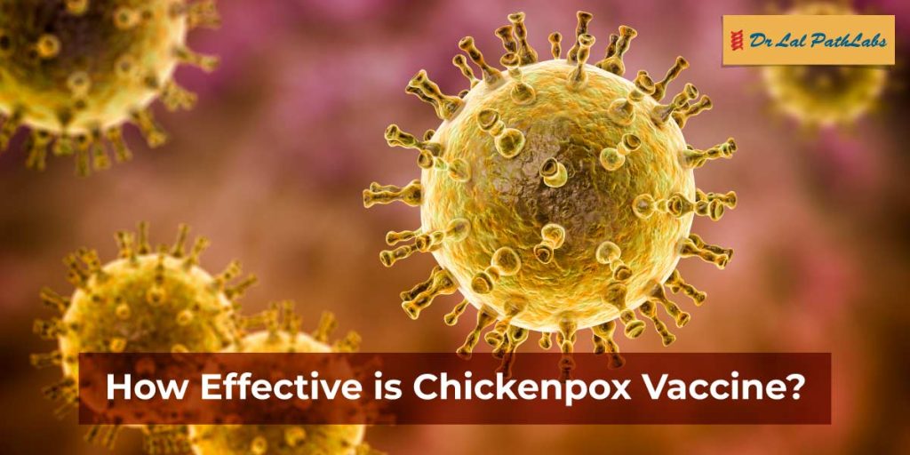 Chickenpox Vaccination