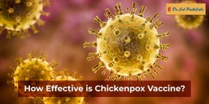 Chickenpox Vaccination