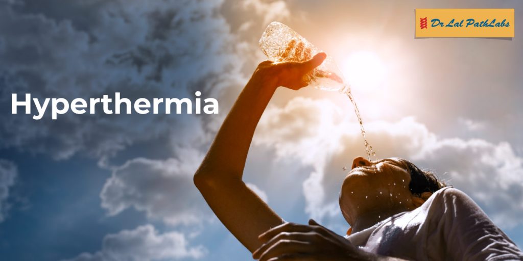 Hyperthermia
