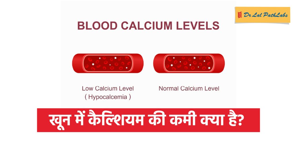 खून में कैल्शियम की कमी क्या है? कारण और लक्षण