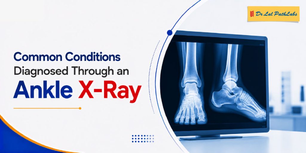 Common Conditions Diagnosed Through an Ankle X-Ray