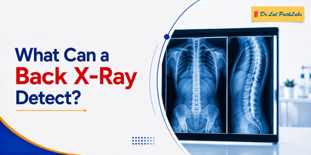 What Can a Back X-Ray Detect? Common Spine Conditions Explained