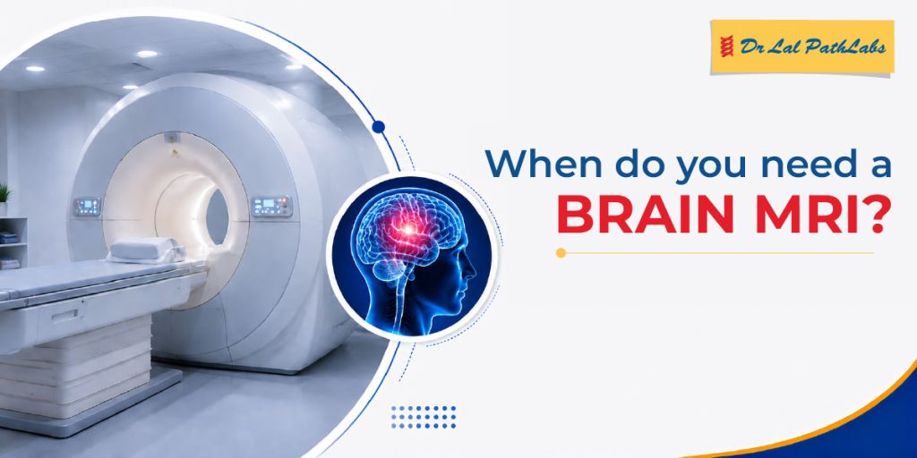 MRI Centre Near Me: When Do You Need a Brain MRI