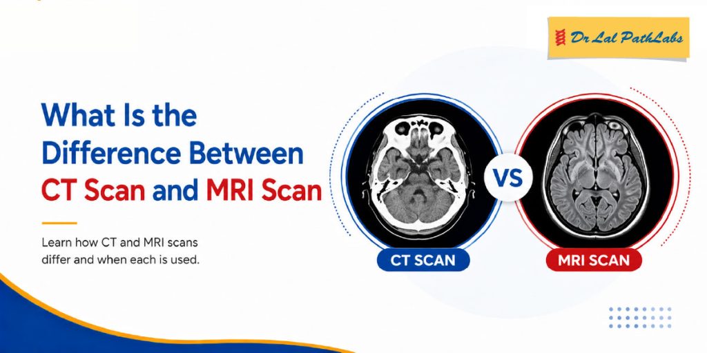 What is the Difference Between a CT Scan and an MRI Scan?