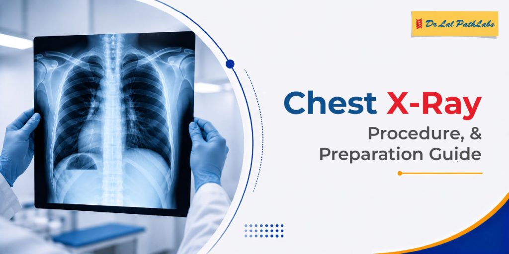 Chest X-Ray Centre Near Me: Procedure and Preparation Guide