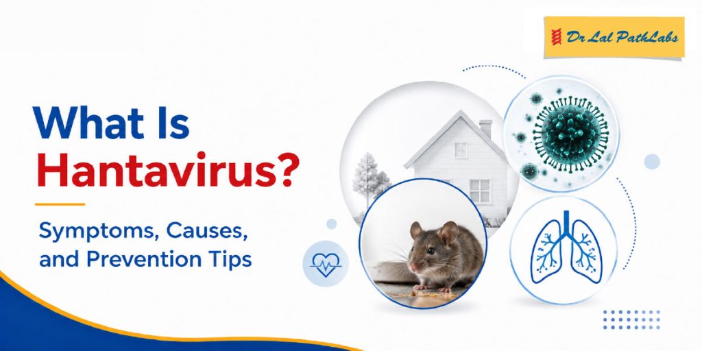 What is Hantavirus? Symptoms, Causes and Prevention Tips