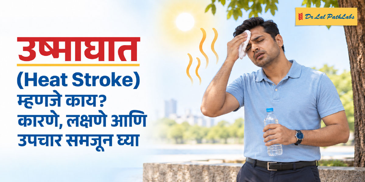 उष्माघात म्हणजे काय? त्याची कारणे, लक्षणे आणि उपचार समजून घ्या उष्माघात म्हणजे काय? त्याची कारणे, लक्षणे आणि उपचार समजून घ्या