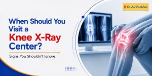 When Should You Visit a Knee X-Ray Centre? Signs You Shouldn’t Ignore When Should You Visit a Knee X-Ray Centre? Signs You Shouldn’t Ignore