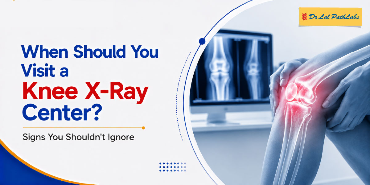 When Should You Visit a Knee X-Ray Centre? Signs You Shouldn’t Ignore