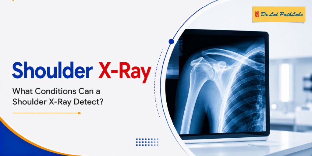 Shoulder X-Ray Near Me: What Conditions Can a Shoulder X-Ray Detect?