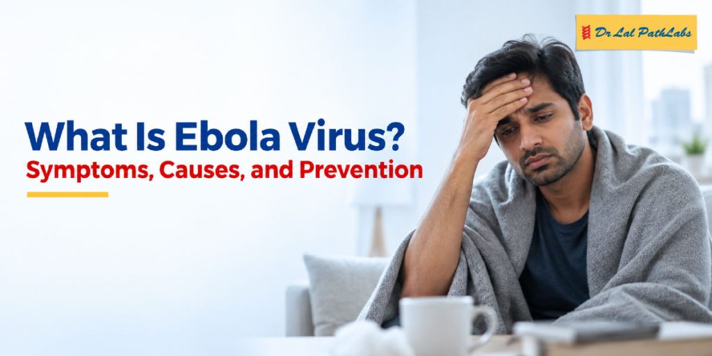 What is the Ebola Virus? Symptoms, Causes, and Prevention